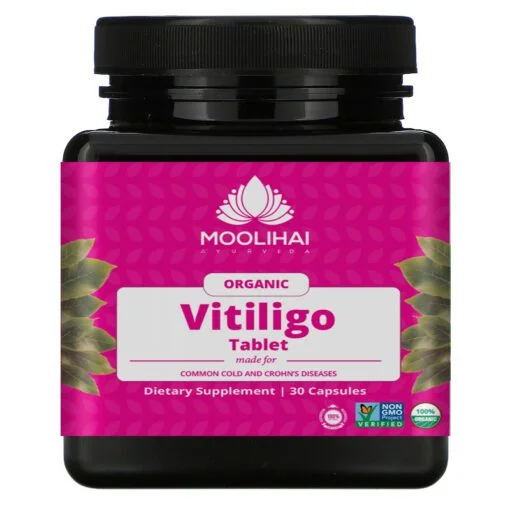 Vitiligo Mathirai