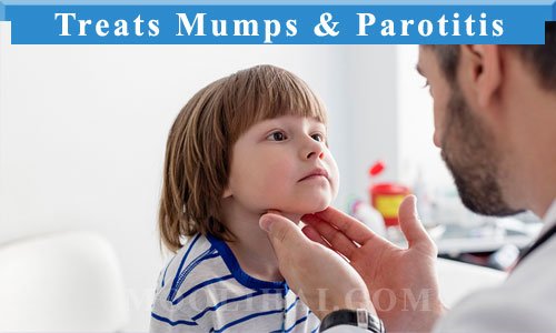 atis-Treats-Mumps-&-Parotitis