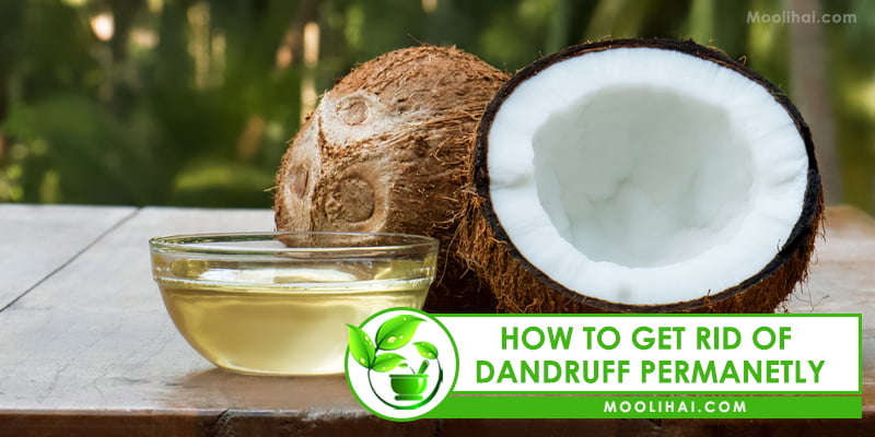 Natural home remedies for dandruff and itchy scalp