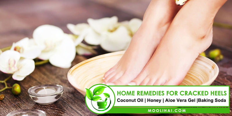 Home remedies for cracked heels