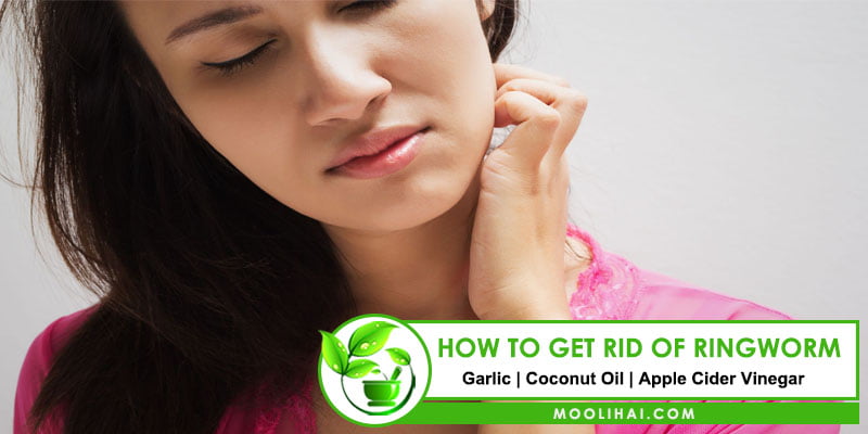 How to get rid of Ringworm